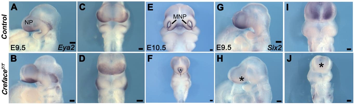 Shaping Faces: The Science of Craniofacial Development and Disorders